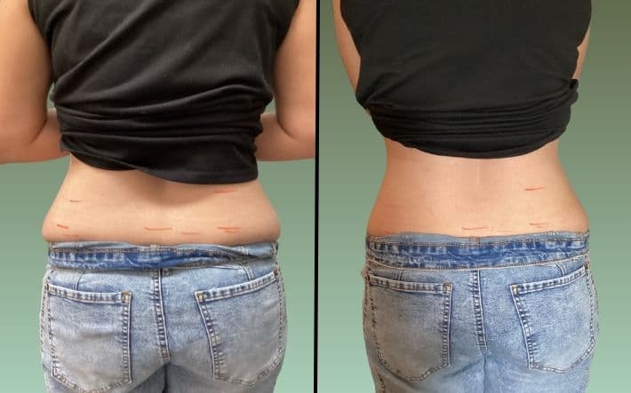 Before and After - 4+ Inches Lost